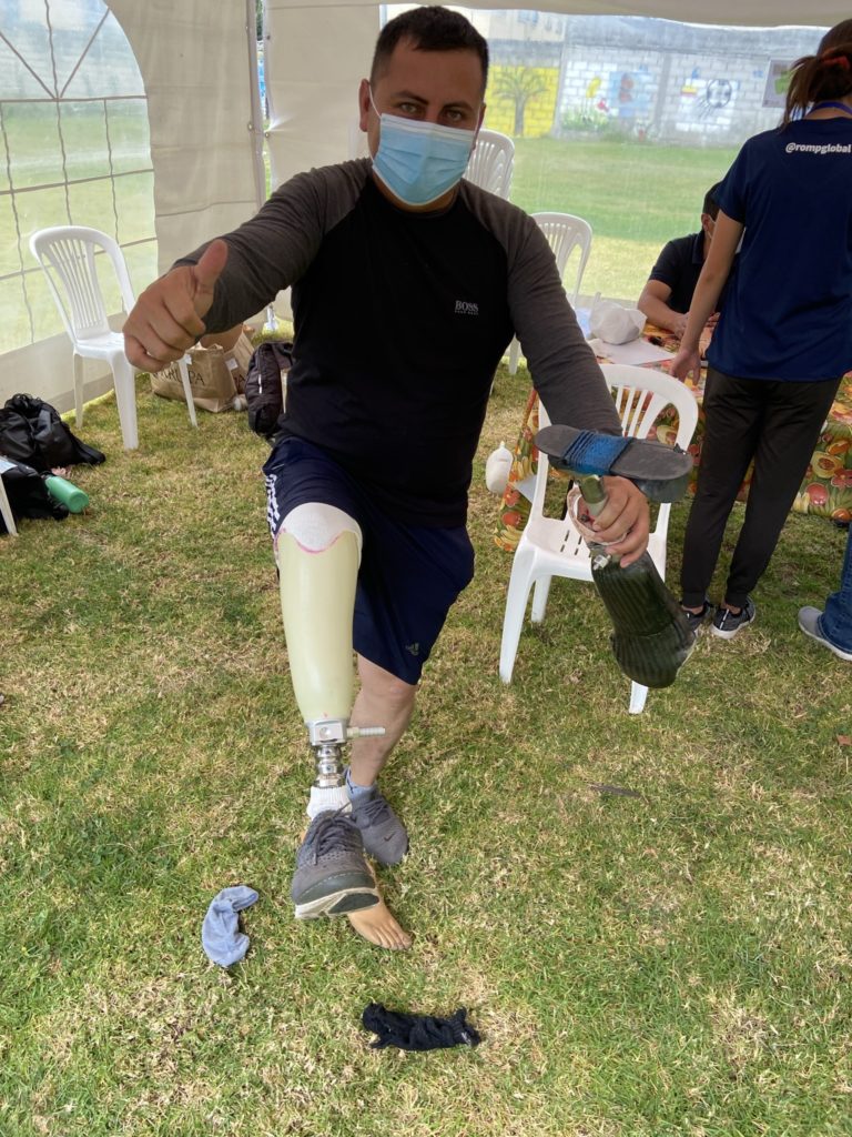 A client With New prosthetic Leg holds an Old device Held Together With Tape And Twine